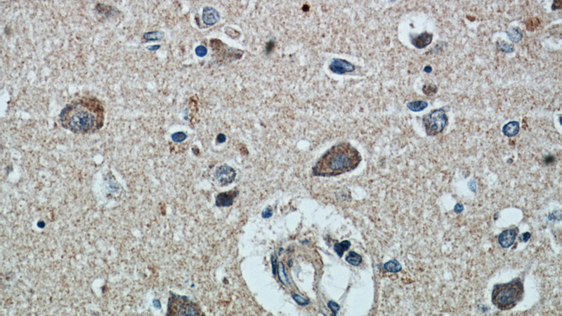 Immunohistochemical of paraffin-embedded human brain using Catalog No:113130(NMB antibody) at dilution of 1:25 (under 40x lens)