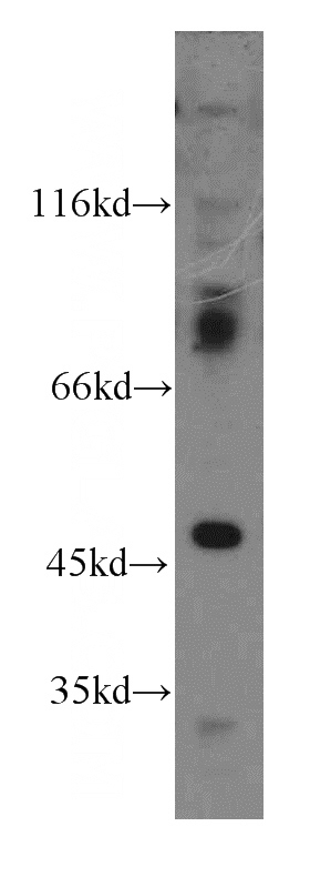 MCF7 cells were subjected to SDS PAGE followed by western blot with Catalog No:114133(PPM1B antibody) at dilution of 1:400