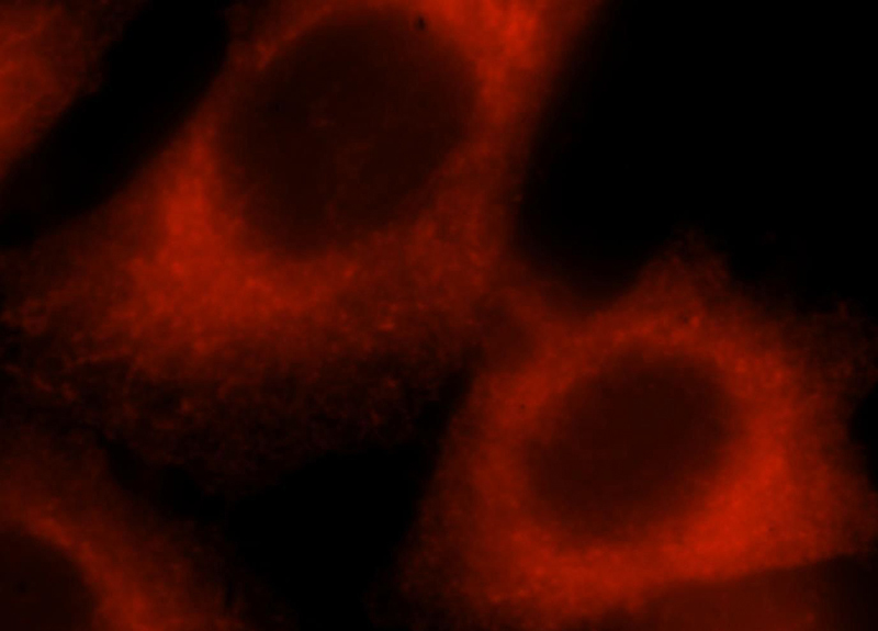 Immunofluorescent analysis of Hela cells, using BCAR1 antibody Catalog No:113534 at 1:25 dilution and Rhodamine-labeled goat anti-rabbit IgG (red).