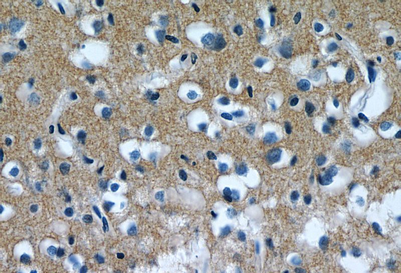 Immunohistochemistry of paraffin-embedded human brain tissue slide using Catalog No:107934(AKAP7 Antibody) at dilution of 1:50 (under 40x lens)