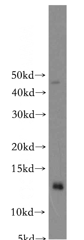 mouse liver tissue were subjected to SDS PAGE followed by western blot with Catalog No:109485(COX16 antibody) at dilution of 1:1000