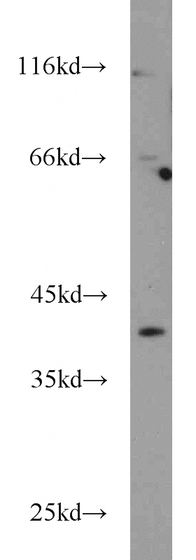 mouse ovary tissue were subjected to SDS PAGE followed by western blot with Catalog No:113439(OSGIN1 antibody) at dilution of 1:1000