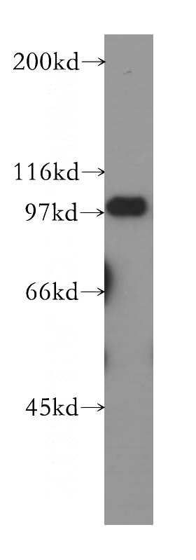 Jurkat cells were subjected to SDS PAGE followed by western blot with Catalog No:114694(RIAM,APBB1IP antibody) at dilution of 1:500