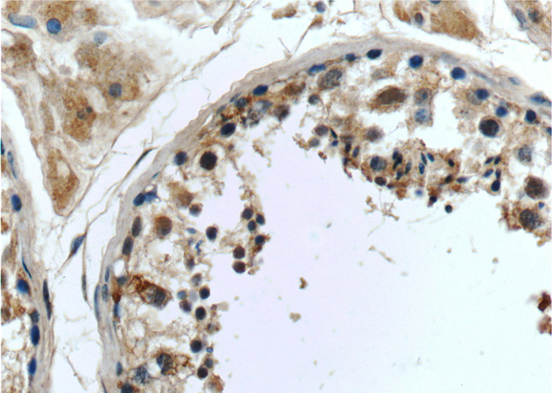 Immunohistochemistry of paraffin-embedded human testis tissue slide using Catalog No:109631(CCDC49 Antibody) at dilution of 1:50 (under 40x lens)