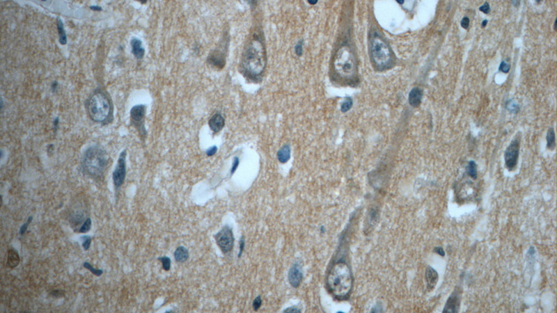 Immunohistochemistry of paraffin-embedded human brain tissue slide using Catalog No:116212(TPPP Antibody) at dilution of 1:50 (under 40x lens)