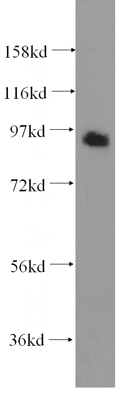 HEK-293 cells were subjected to SDS PAGE followed by western blot with Catalog No:111138(GPRASP2 antibody) at dilution of 1:500