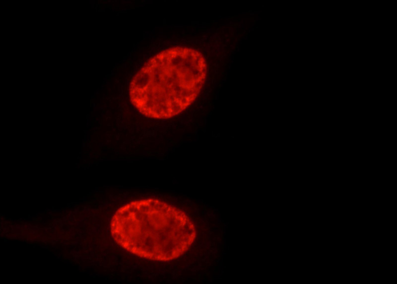 Immunofluorescent analysis of HepG2 cells, using DHX9 antibody Catalog No:109935 at 1:100 dilution and Rhodamine-labeled goat anti-rabbit IgG (red).