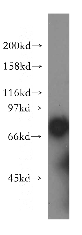 COLO 320 cells were subjected to SDS PAGE followed by western blot with Catalog No:115311(SLC20A2 antibody) at dilution of 1:400