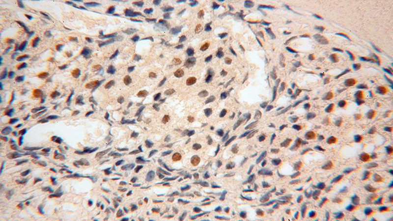 Immunohistochemical of paraffin-embedded human ovary using Catalog No:114035(POLR1C antibody) at dilution of 1:200 (under 40x lens)