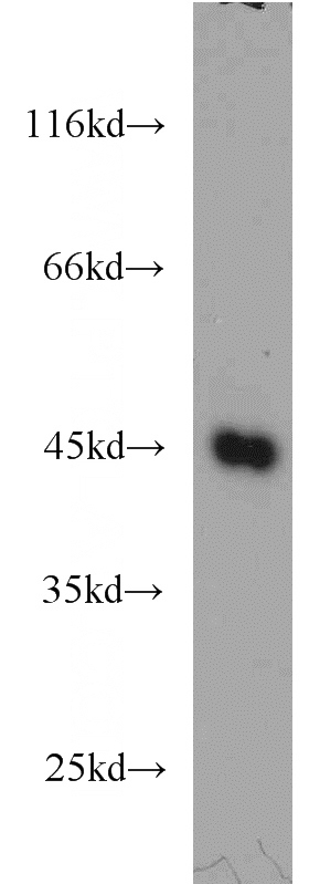 K-562 cells were subjected to SDS PAGE followed by western blot with Catalog No:113144(NFE2 antibody) at dilution of 1:500