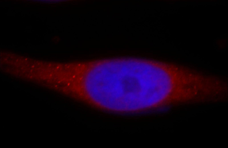 Immunofluorescent analysis of Hela cells, using RADIL antibody Catalog No:114520 at 1:25 dilution and Rhodamine-labeled goat anti-rabbit IgG (red). Blue pseudocolor = DAPI (fluorescent DNA dye).