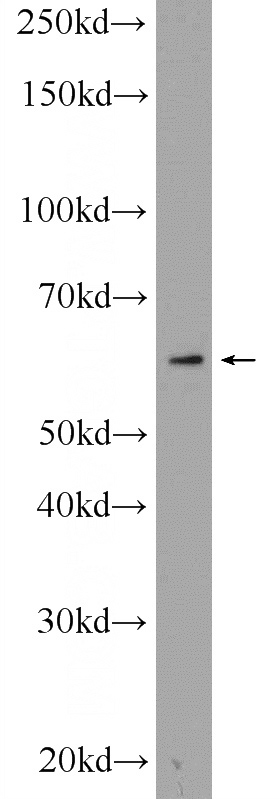 HL-60 cells were subjected to SDS PAGE followed by western blot with Catalog No:109708(CYP4F3 Antibody) at dilution of 1:300