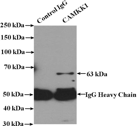 IP Result of anti-CAMKK1 (IP:Catalog No:108923, 4ug; Detection:Catalog No:108923 1:1000) with Jurkat cells lysate 4000ug.