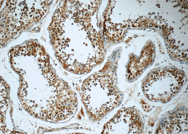 Immunohistochemistry of paraffin-embedded human testis tissue slide using Catalog No:107362(KIFAP3 Antibody) at dilution of 1:50