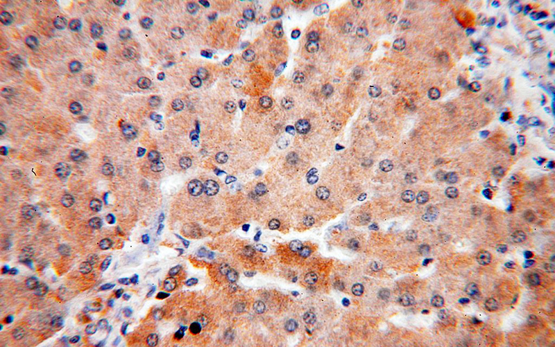 Immunohistochemical of paraffin-embedded human liver using Catalog No:114726(RNASE11 antibody) at dilution of 1:50 (under 40x lens)