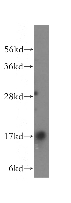 mouse skeletal muscle tissue were subjected to SDS PAGE followed by western blot with Catalog No:109321(mitoNEET,CISD1 antibody) at dilution of 1:4000