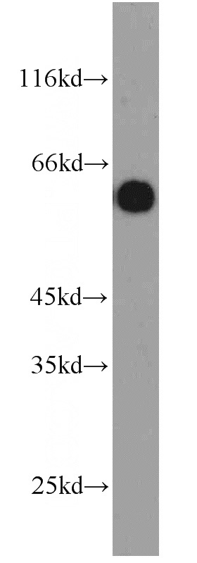 HepG2 cells were subjected to SDS PAGE followed by western blot with Catalog No:108948(CBX6 antibody) at dilution of 1:1000