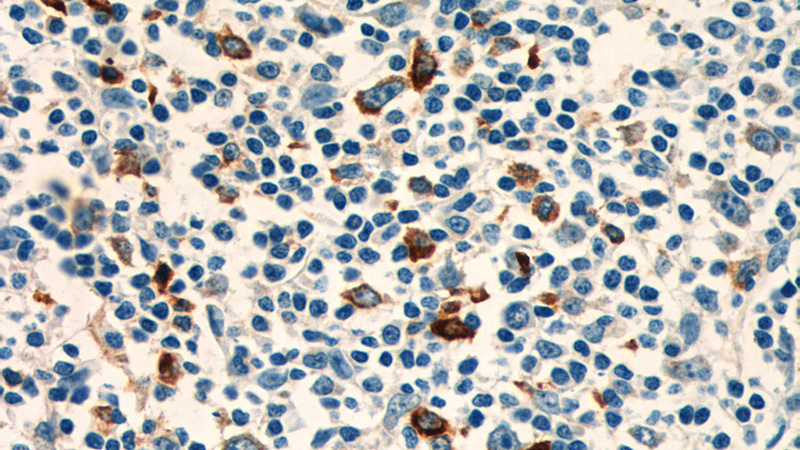 Immunohistochemistry of paraffin-embedded human tonsillitis tissue slide using Catalog No:113483(PADI4 Antibody) at dilution of 1:200 (under 40x lens)