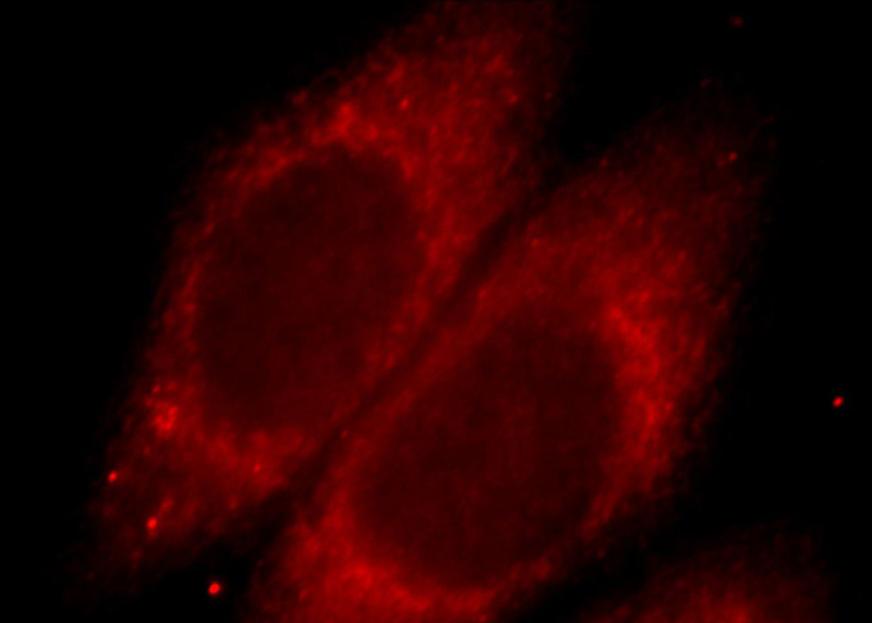 Immunofluorescent analysis of HepG2 cells, using SH3BP1 antibody 20541-AP at 1:25 dilution and Rhodamine-labeled goat anti-rabbit IgG (red).
