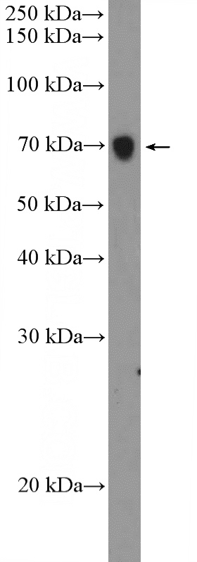 A375 cells were subjected to SDS PAGE followed by western blot with Catalog No:113987(PODN Antibody) at dilution of 1:600