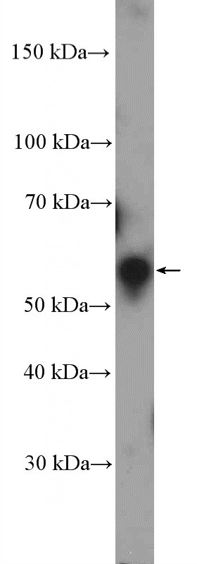 HEK-293 cells were subjected to SDS PAGE followed by western blot with Catalog No:110964(GHDC Antibody) at dilution of 1:600