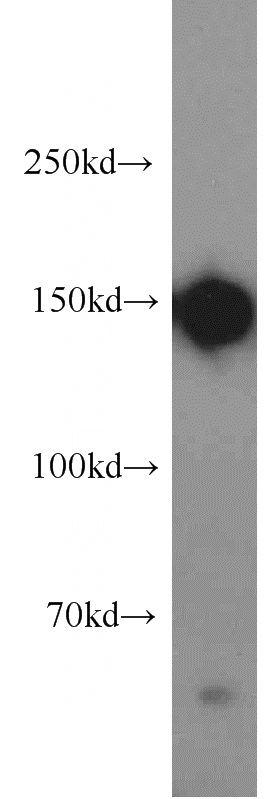 HepG2 cells were subjected to SDS PAGE followed by western blot with Catalog No:110027(DSG2 antibody) at dilution of 1:1000