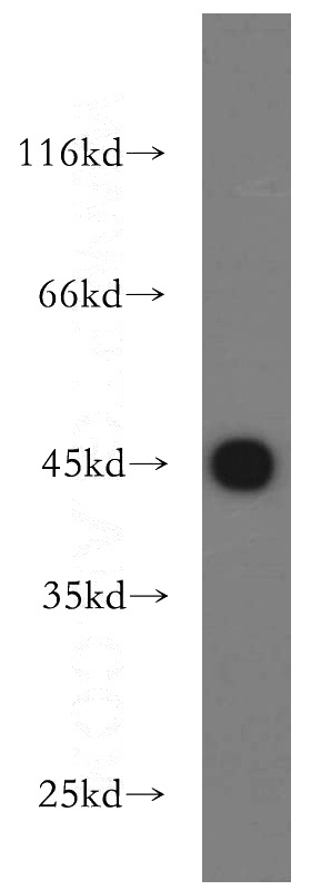 human brain tissue were subjected to SDS PAGE followed by western blot with Catalog No:116635(UQCRC1 antibody) at dilution of 1:500
