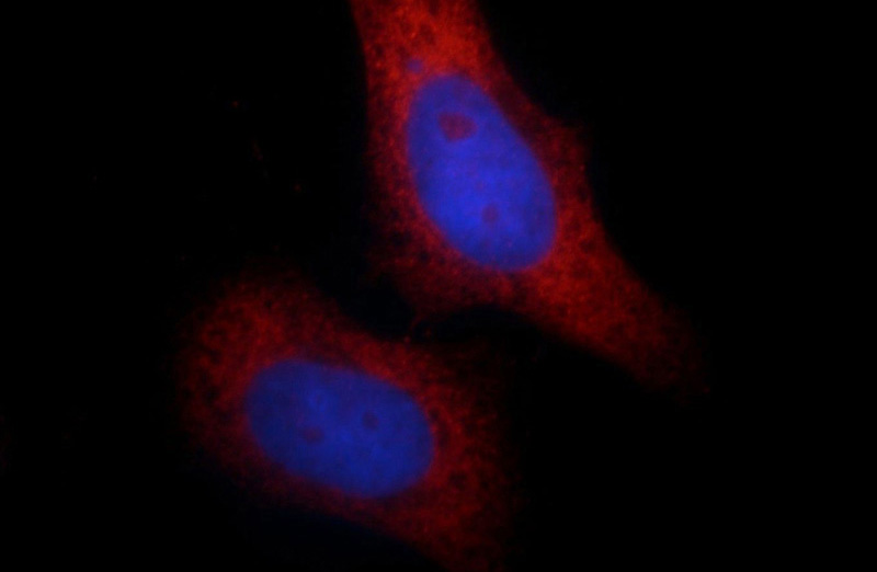 Immunofluorescent analysis of HepG2 cells, using SCEL antibody Catalog No:114990 at 1:25 dilution and Rhodamine-labeled goat anti-rabbit IgG (red). Blue pseudocolor = DAPI (fluorescent DNA dye).