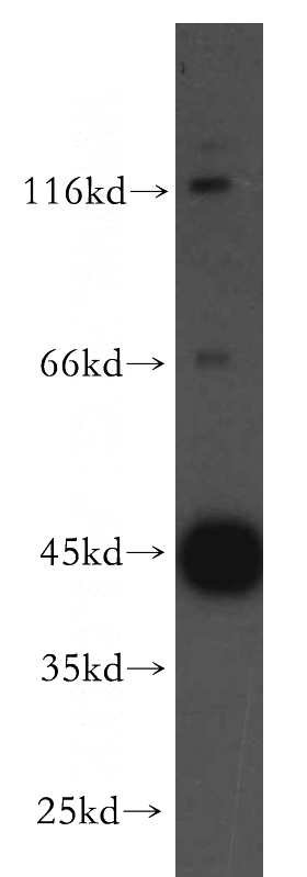 human brain tissue were subjected to SDS PAGE followed by western blot with Catalog No:116471(UBAC1 antibody) at dilution of 1:500