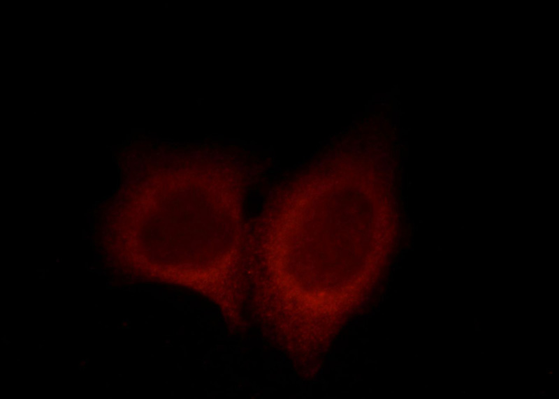 Immunofluorescent analysis of Hela cells, using UBAP1 antibody Catalog No:116473 at 1:25 dilution and Rhodamine-labeled goat anti-rabbit IgG (red).
