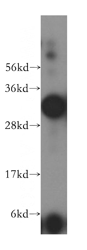 HeLa cells were subjected to SDS PAGE followed by western blot with Catalog No:112265(LACTB2 antibody) at dilution of 1:500