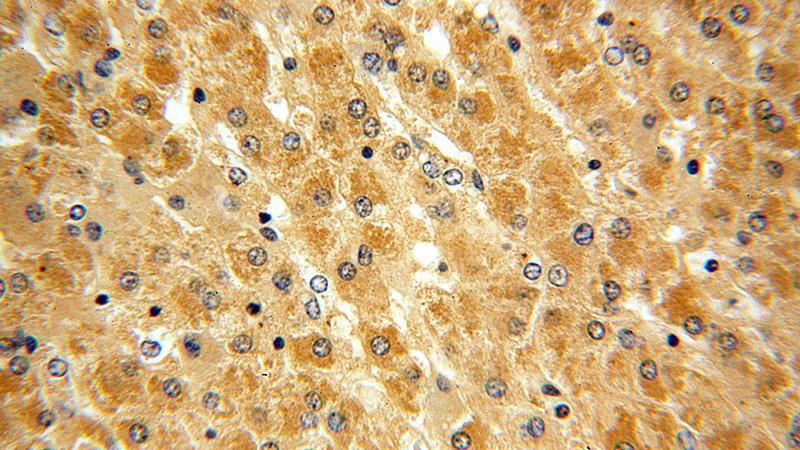 Immunohistochemical of paraffin-embedded human liver using Catalog No:115589(SRI antibody) at dilution of 1:50 (under 40x lens)