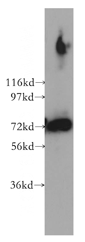 human brain tissue were subjected to SDS PAGE followed by western blot with Catalog No:114185(PREPL antibody) at dilution of 1:400