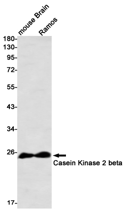 Western blot detection of Casein Kinase 2 beta in mouse Brain,Ramos using Casein Kinase 2 beta Rabbit mAb(1:1000 diluted)