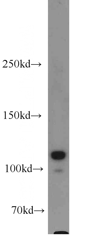 MCF7 cells were subjected to SDS PAGE followed by western blot with Catalog No:111705(HSPH1 antibody) at dilution of 1:1000