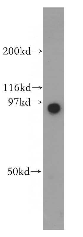 PC-3 cells were subjected to SDS PAGE followed by western blot with Catalog No:111013(GNS antibody) at dilution of 1:600