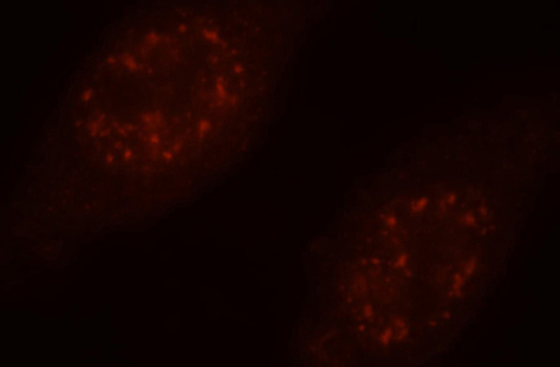 Immunofluorescent analysis of HepG2 cells, using PSME4 antibody Catalog No:114249 at 1:25 dilution and Rhodamine-labeled goat anti-rabbit IgG (red).