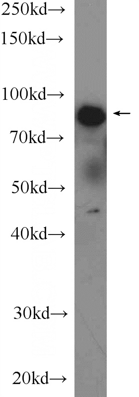 human saliva tissue were subjected to SDS PAGE followed by western blot with Catalog No:112308(LPO Antibody) at dilution of 1:1000