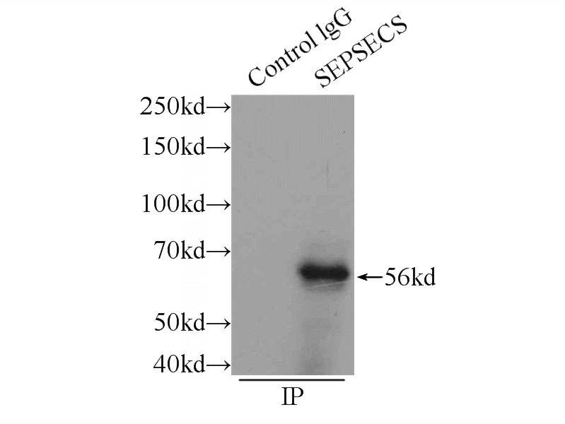 IP Result of anti-SEPSECS (IP:Catalog No:115291, 3ug; Detection:Catalog No:115291 1:800) with mouse liver tissue lysate 6000ug.