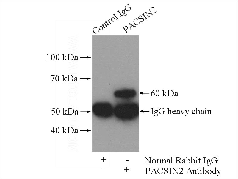 IP Result of anti-PACSIN2 (IP:Catalog No:113479, 4ug; Detection:Catalog No:113479 1:500) with NIH/3T3 cells lysate 1200ug.