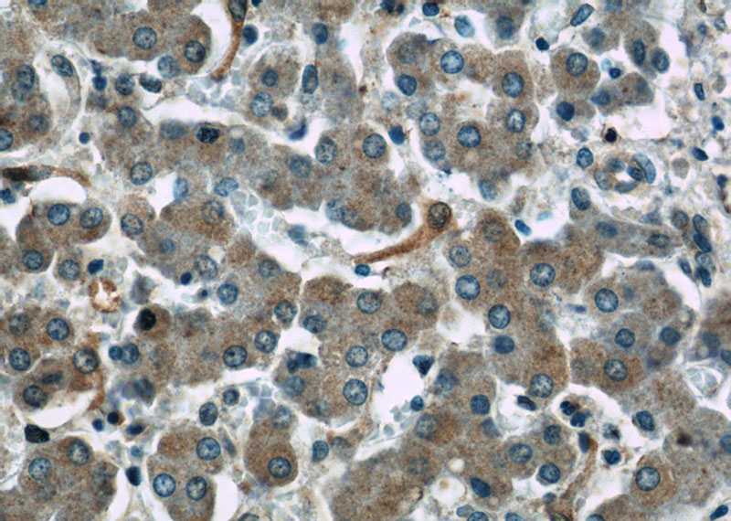 Immunohistochemistry of paraffin-embedded human liver slide using Catalog No:114836(RPS25 Antibody) at dilution of 1:50