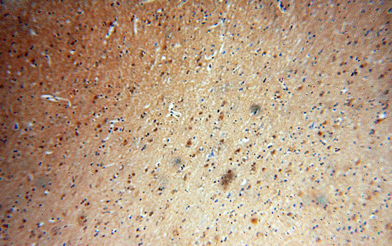 Immunohistochemical of paraffin-embedded human brain using Catalog No:109260(CETN2 antibody) at dilution of 1:50 (under 10x lens)