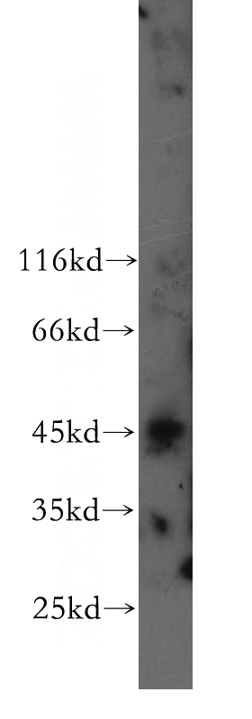 BxPC-3 cells were subjected to SDS PAGE followed by western blot with Catalog No:116953(ZNF174 antibody) at dilution of 1:500