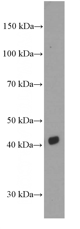 human testis tissue were subjected to SDS PAGE followed by western blot with Catalog No:107048(CD1D Antibody) at dilution of 1:1000