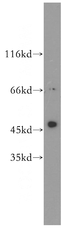 human liver tissue were subjected to SDS PAGE followed by western blot with Catalog No:108108(AZIN1 antibody) at dilution of 1:500