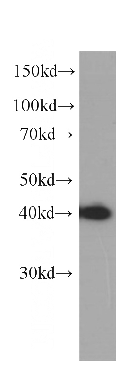 K-562 cells were subjected to SDS PAGE followed by western blot with Catalog No:107279(IGBP1 antibody) at dilution of 1:1000