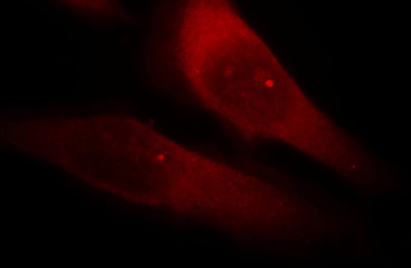 Immunofluorescent analysis of Hela cells, using RABGAP1L antibody Catalog No:114497 at 1:25 dilution and Rhodamine-labeled goat anti-rabbit IgG (red).