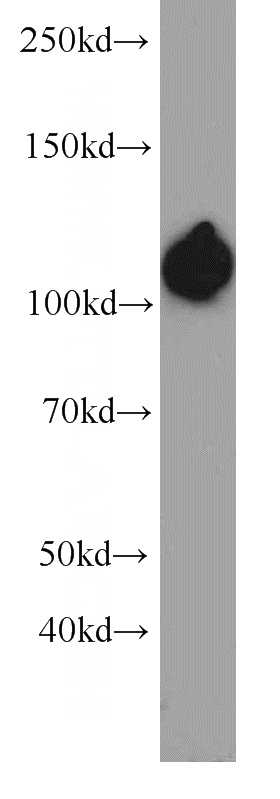 PC-3 cells were subjected to SDS PAGE followed by western blot with Catalog No:107351(ITGA3 antibody) at dilution of 1:1000