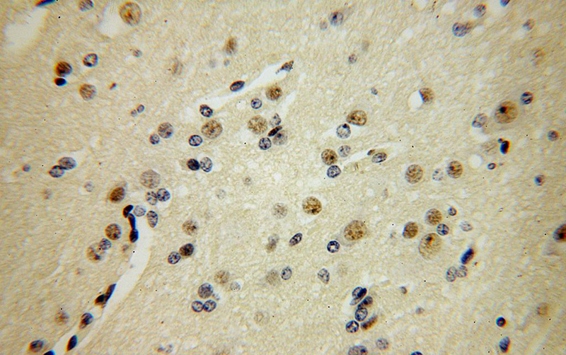 Immunohistochemical of paraffin-embedded human brain using Catalog No:110516(FANCC antibody) at dilution of 1:100 (under 40x lens)