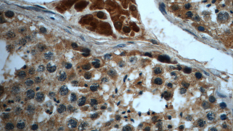 Immunohistochemistry of paraffin-embedded human testis slide using Catalog No:111393(HEATR4 Antibody) at dilution of 1:50 (under 40x lens)
